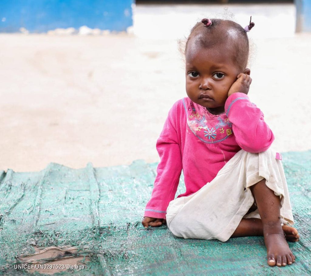 Un enfant qui souffre de malnutrition photographié à l'unité de réhabilitation nutritionnelle de Bétou, en République démocratique du Congo. © UNICEF/UN0287523/Diefaga