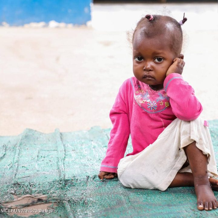 Un enfant qui souffre de malnutrition photographié à l'unité de réhabilitation nutritionnelle de Bétou, en République démocratique du Congo. © UNICEF/UN0287523/Diefaga