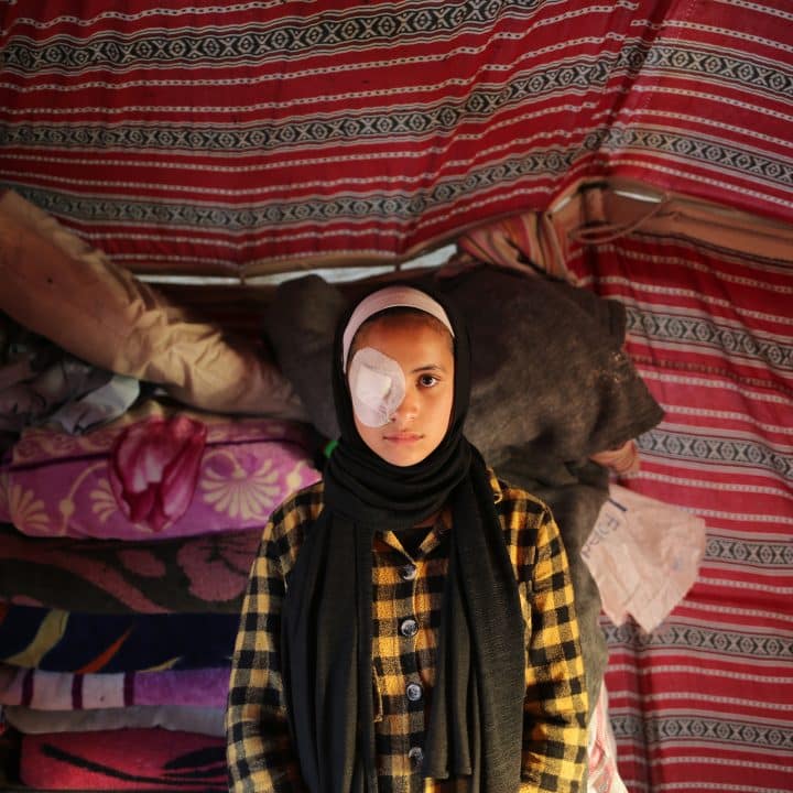 Dans la bande de Gaza, Abrar,15 ans, a été touchée à l'œil droit lorsque sa maison a été bombardée. © UNICEF/UNI544675/El Baba