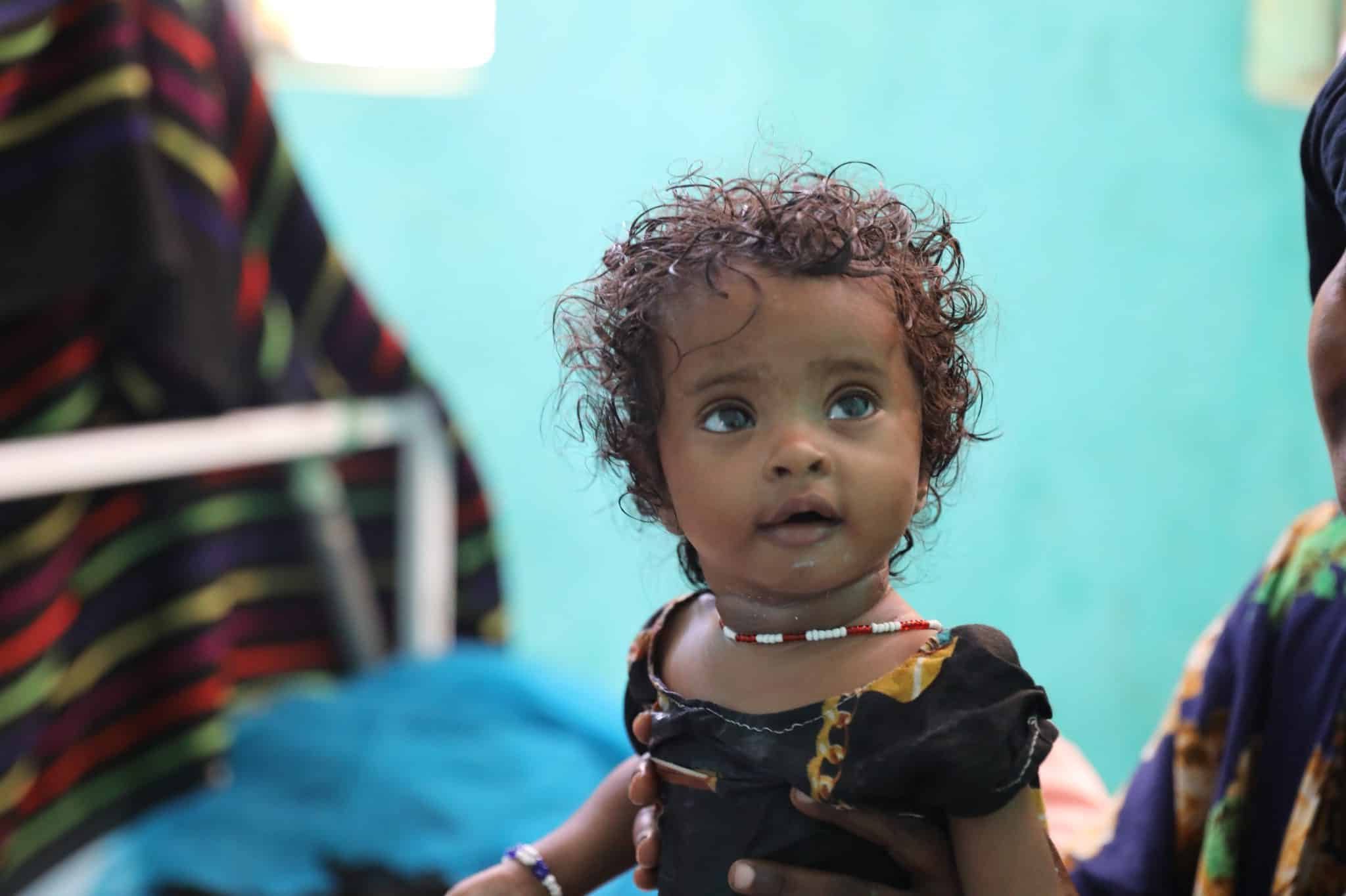 Medina Mohammed a été admise à l'hôpital Asayita car elle présentait des signes de malnutrition.© UNICEF/UN0848560/Assefa