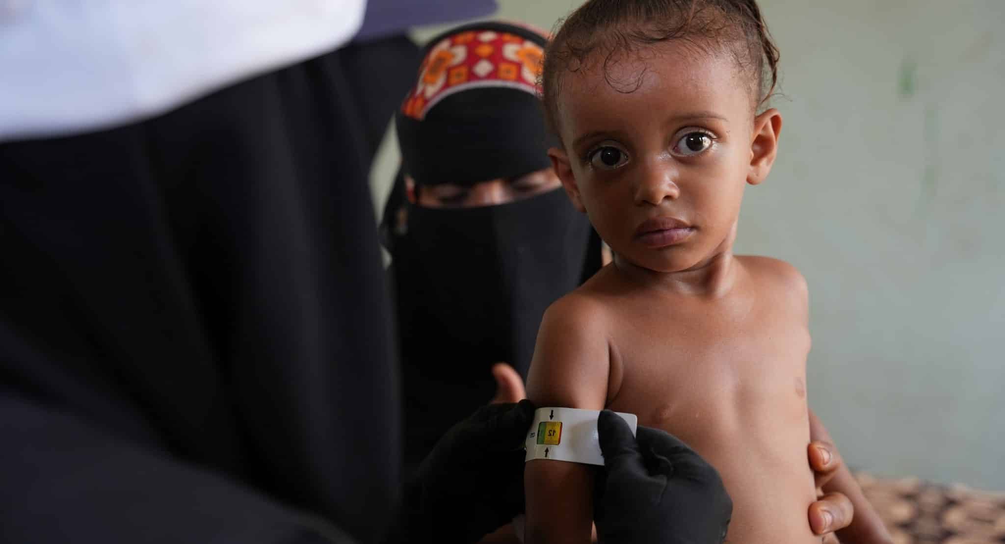 Au Yémen, grâce au soutien de l'UNICEF, des enfants sont dépistés pour identifier les cas de malnutrition © UNICEF/UNI441659/Hayyan