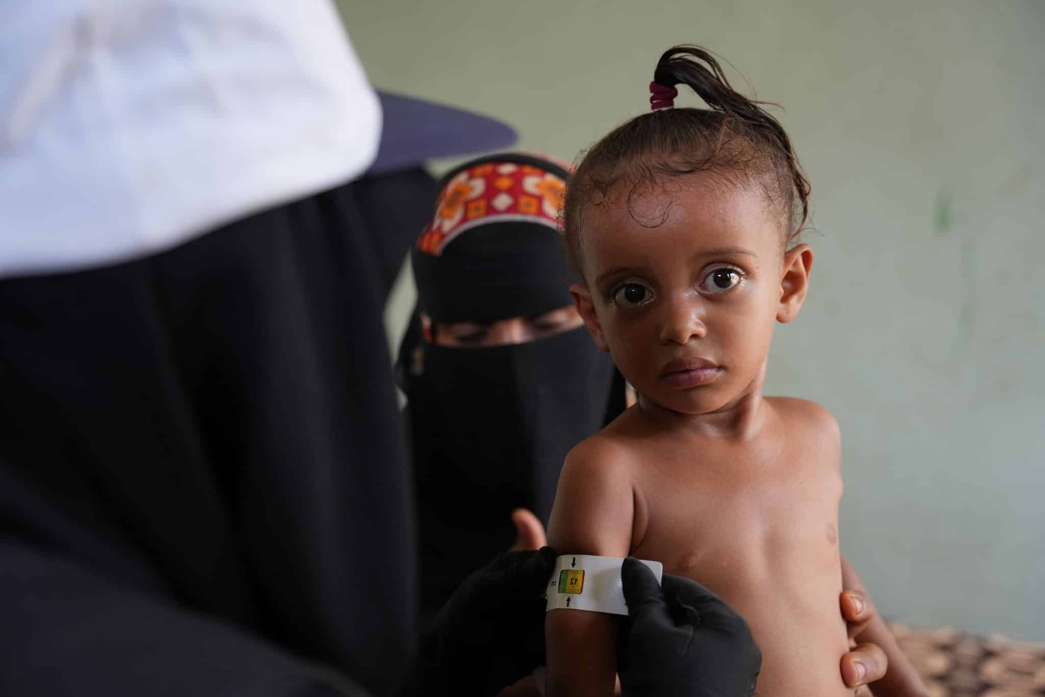 Au Yémen, grâce au soutien de l'UNICEF, des enfants sont dépistés pour identifier les cas de malnutrition © UNICEF/UNI441659/Hayyan