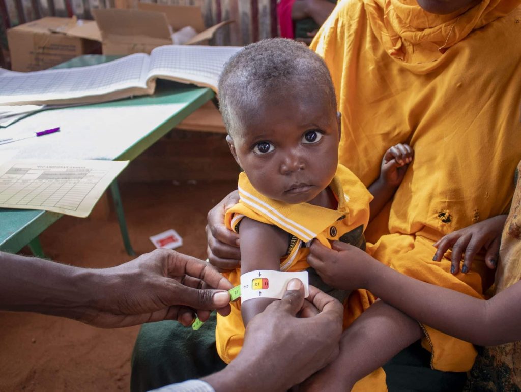 enfant malnutrition somalie