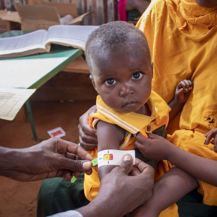 enfant malnutrition somalie