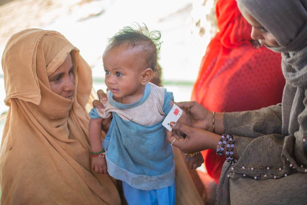 Aisha, 1 an, souffre de malnutrition aiguë sévère et nécessite un traitement immédiat. © UNICEF/UNI529921/Elfatih