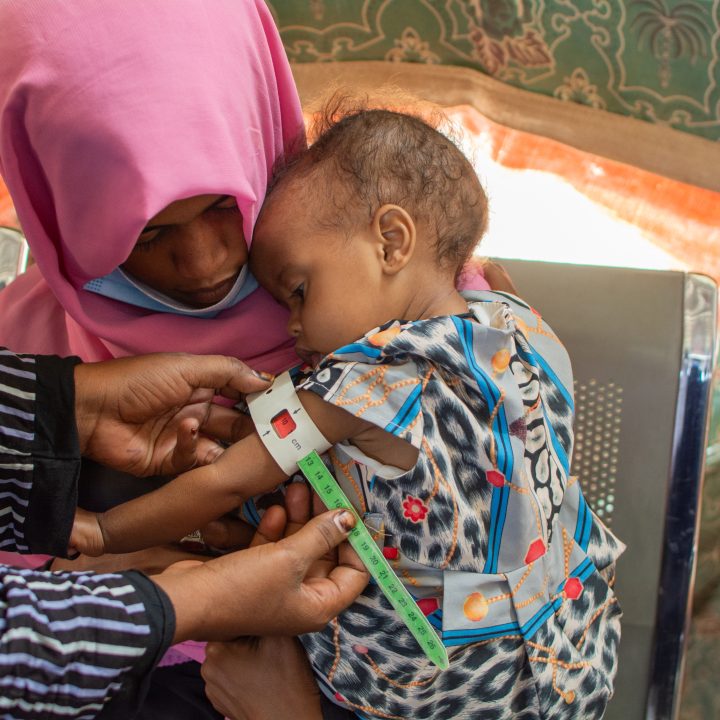 Dans le centre de santé Hayal Arab à Atbara, dans l'État du Nil au Soudan, cette petite fille âgé d'un an est prise en charge pour malnutrition aiguë sévère. © UNICEF/UNI607338/Ahmed