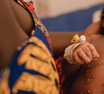 RDC : les enfants menacés par la recrudescence de Mpox