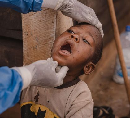 Mpox : L’UNICEF lance un appel de 58,8 millions de dollars pour faire face à la crise