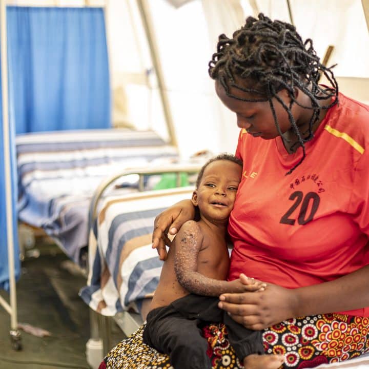 Floride, la mère d'Amie-Grâce, âgée d'un an et demi, tient dans ses bras son enfant, qui est atteint du mpox. © UNICEF/UNI648734/Muco