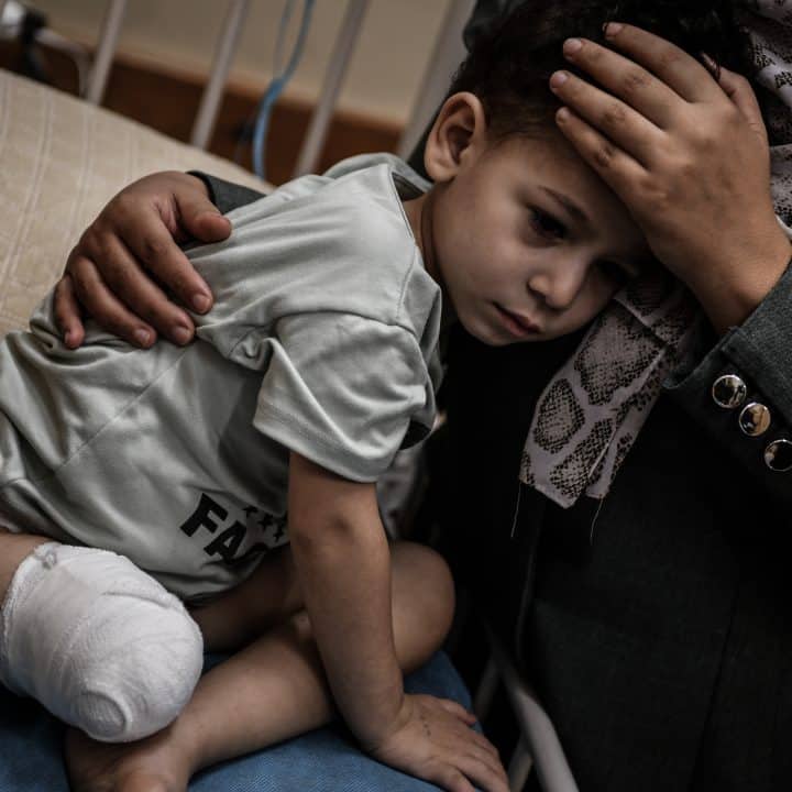 Ahmad, 3 ans, de la ville de Nuseirat, dans le centre de la bande de Gaza, a dû se faire amputer après le bombardement de sa maison, le 23 octobre 2023. © UNICEF/UNI488694/Zaqout