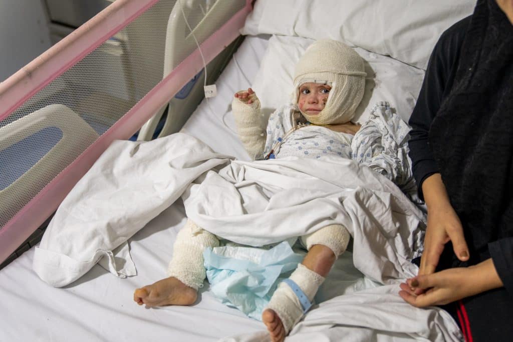 Ivana, 2 ans, est originaire de Deir Qanoun al-Nahr au sud du Liban. Une frappe aérienne a mis le feu à sa maison. Sévèrement brûlée, elle est en soins intensifs à l'hôpital Geitaoui, où elle reçoit un traitement. © UNICEF/UNI671093/Choufany