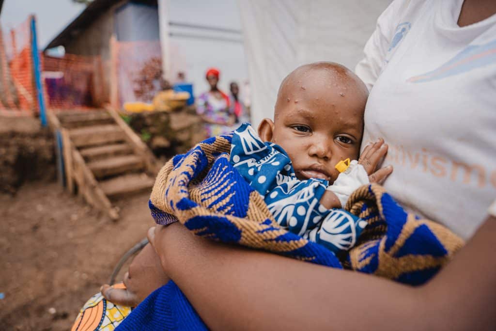 Le 10 septembre 2024, dans la province du Sud-Kivu en République démocratique du Congo, Eliane, 9 mois, est dans les bras de sa mère Rosine, devant le centre de traitement de la Mpox, soutenu par l'UNICEF. ©UNICEF/UNI648015