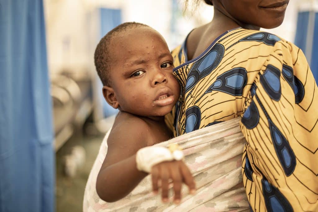 Don Bertrand, âgé de 10 mois, est atteint de la Mpox. Il suit un traitement au sein de la Clinique Prince Louis au Burundi soutenue par l'UNICEF. © UNICEF/UNI649401/UNICEF