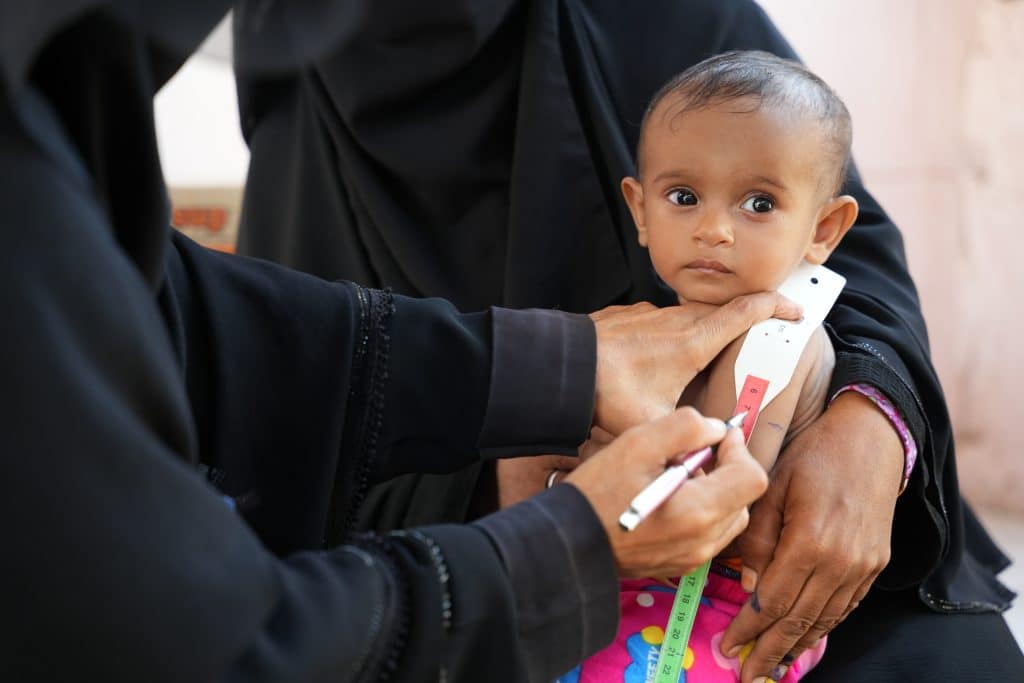 Au Yémen, un enfant souffrant de malnutrition est examiné par un agent de santé lors d'une visite de l'unité de soin mobile soutenue par l'UNICEF. © UNICEF/UNI708776/ALfilastini