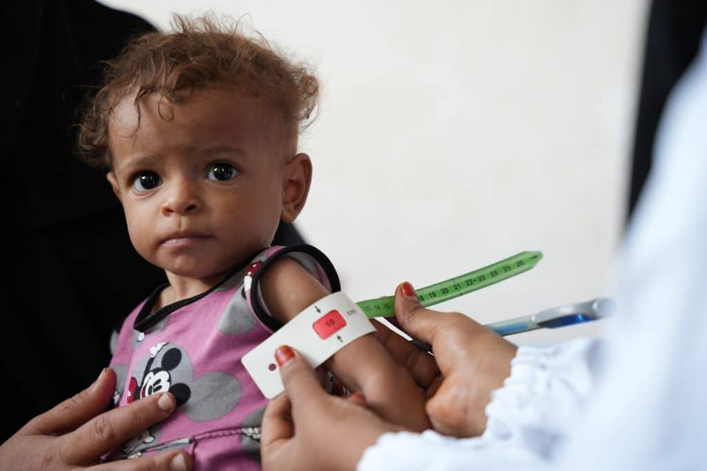 Au Yémen, cet enfant se fait dépister. Il souffre de malnutrition aiguë sévère. © UNICEF/UNI708819/ALfilastini